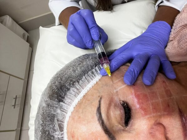 Laserterapia