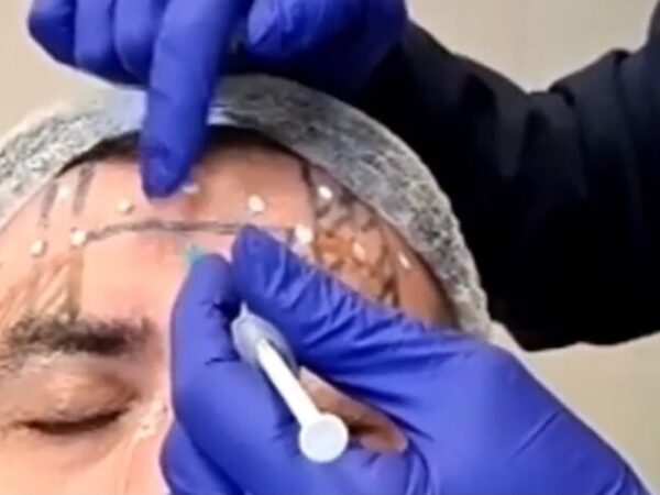 Laserterapia 3