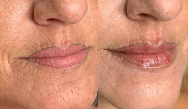 labial labial